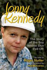 Watch The Boy Whose Skin Fell Off Solarmovie