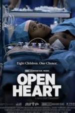 Watch Open Heart Solarmovie