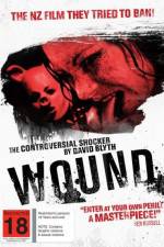 Watch Wound Solarmovie