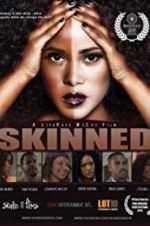 Watch Skinned Solarmovie