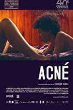 Watch Acné Solarmovie